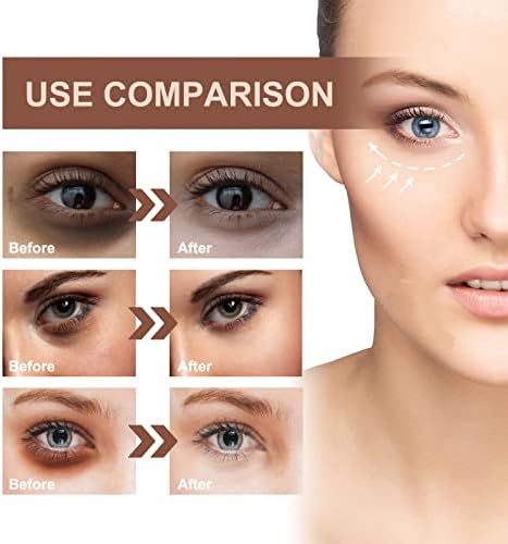 HMDABD שלמות x עיגולים כהים של אור פנים, החלקה קמטים הידקים שקיות עיניים לחות עיגולים כהים מתקנים לעור עיניים
