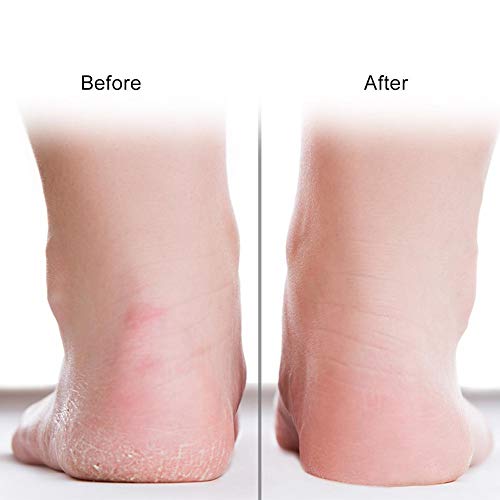 סיליקון גרביים, לחות ג ' ל גרבי רגל אנטי פיצוח מגן רגל טיפול כלי מניעת גרבי עבור יבש רגליים קרסוליים סדוק העקב תיקון