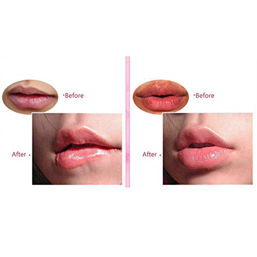יופי שפתיים מסכות 20-חבילה קולגן קריסטל ג ' ל שפתיים טיפול מסכת לחות לחות מהות,להסיר עור מת, אנטי סדוק,נגד קמטים